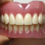 ساخت دندان طرح لبخند