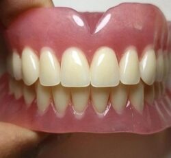ساخت دندان طرح لبخند