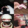 دندانسازی دنتاژ (۳۰٪ تخفیف)