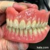 دندانسازی ساخت دست دندان مصنوعی با ضمانت در یک هفته