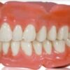 ساخت دندان مصنوعی برای افراد کاملا بی دندان