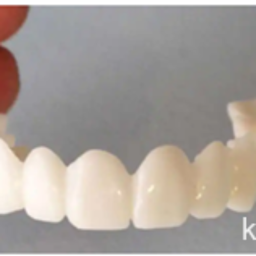 دندان مصنوعی با تضمین