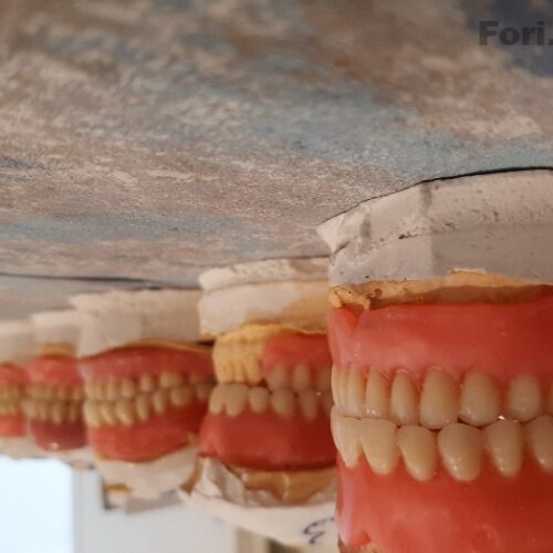 دندانسازی دنرانپزشکی دندان مصنوعی متحرک