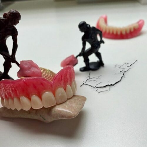 دست دندان مصنوعی متحرک ژله ای دندانسازی دندانپزشکی کرمان