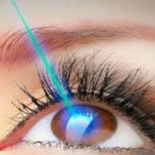 عمل لازک و لیزیک چشم (حذف دائم عینک)