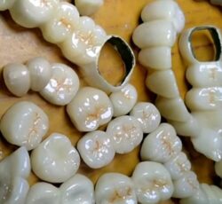 کاراموز دندانسازی با اموزش و حقوق