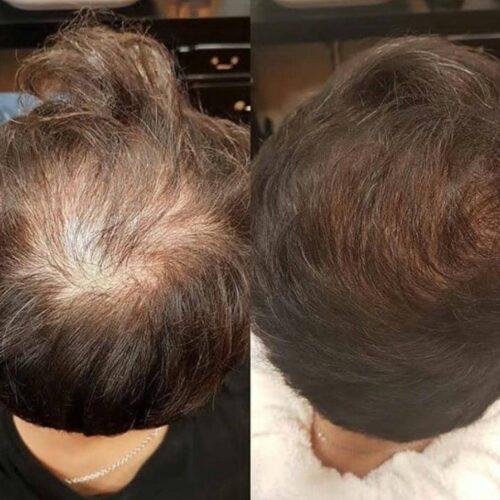 اسپری قطع ریزش و رویش مجدد مو گیت پی