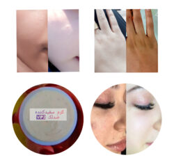 کرم سفیدکننده …ضدلک …ضدجوش