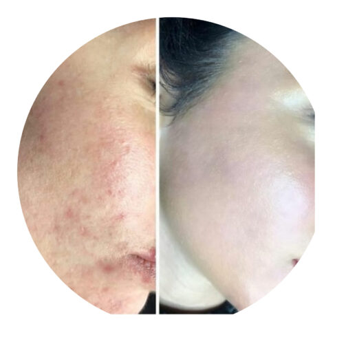 کرم سفیدکننده …ضدلک …ضدجوش