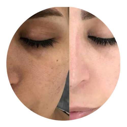 کرم سفیدکننده …ضدلک …ضدجوش