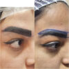 کاشت ابروی طبیعی