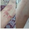 مراقبت پوست
