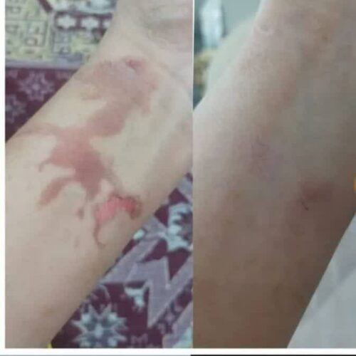 مراقبت پوست