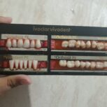 دندان مصنوعی ایوکلار ویوادنت اصل دست کامل