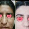 کرم سفیدکننده بنت والجمیل