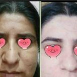 کرم سفیدکننده بنت والجمیل