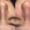 فیشال صورت