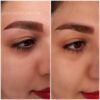 لیزر فیشال دستگاه لاغریEMS لیفت ابرو
