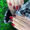 کاشت و ترمیم ژل+لمینت