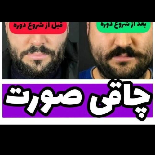 گیاهی تپل شو