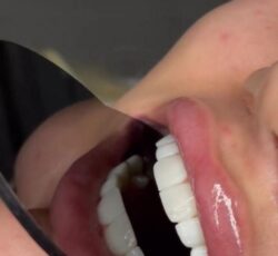 دستیار دندانپزشک