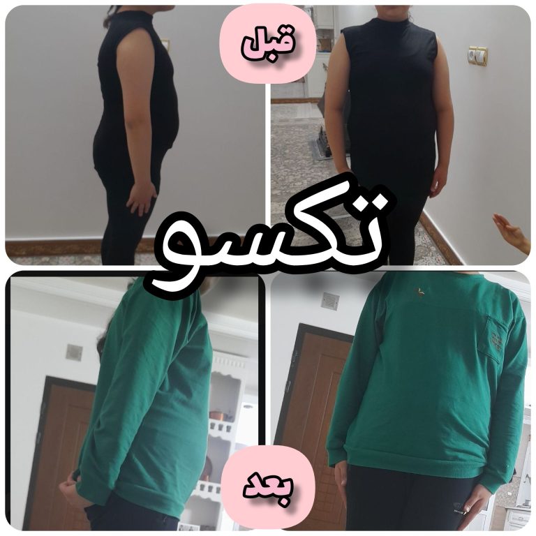 لاغری تضمینی