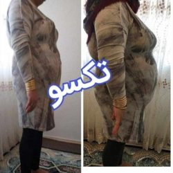 لاغری تضمینی