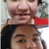 پاکسازی صورت با مواد