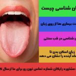تشخیص بیماری از روی سطح زبان