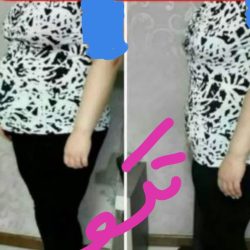 لاغری تضمینی