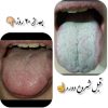 زبانشناسی واصلاح مزاج