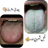 زبانشناسی واصلاح مزاج