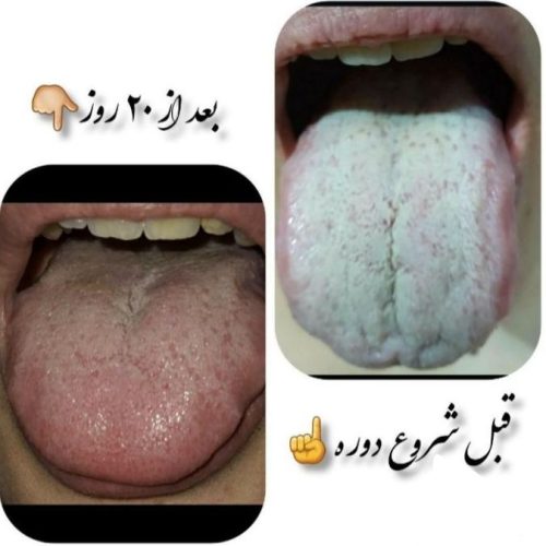 زبانشناسی واصلاح مزاج