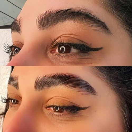 هزینه متریال از شما،خدمات رایگان از من(لیفت و بافت)