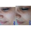 پاکسازی وفیشال پوست