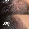 تاتو صورت و بدن