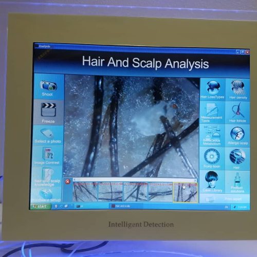 اسکراب مو (رونوفل)