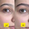 مدل خدمات تخصصی میکروبلیدینگ ابرو