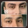 آموزش میکرو بلیدینگ