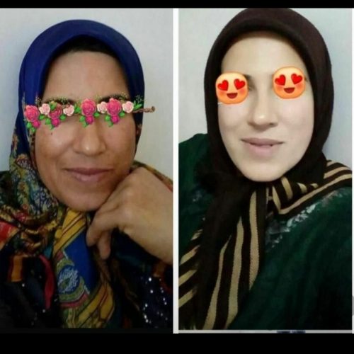 کرم سفید کننده گیاهی بی نظیر وضمانتی