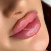 ژل بوتاکس نخ مزو خالی داری چال لپ