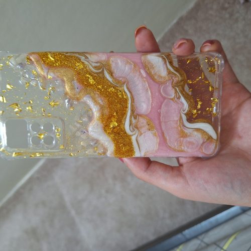 قاب شیائومی ردمی نوت 11pro