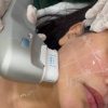 لیزر آقایان بانوان فردیس هایفو فیشال بوتاکس