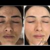 کرم سفید کننده گیاهی بی نظیر وضمانتی