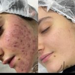 کرم سفید کننده گیاهی بی نظیر وضمانتی