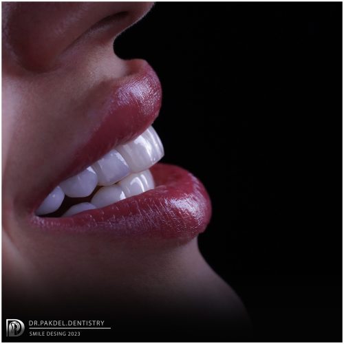 دندانپزشکی دکتر پاکدل، کلیه خدمات دندانپزشکی