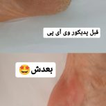 پدیکور و کف سابی