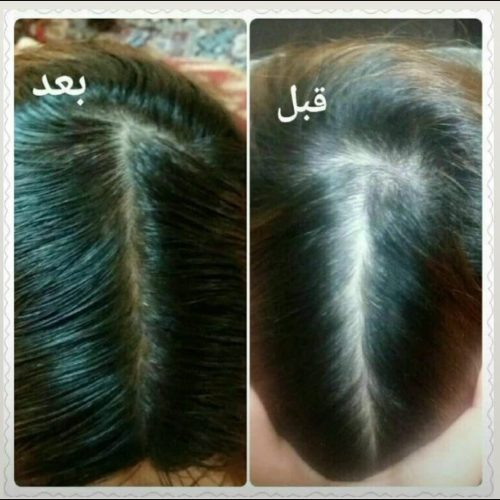 مشاور و نماینده محصولات لدورا