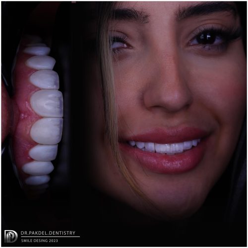 دندانپزشکی دکتر پاکدل، کلیه خدمات دندانپزشکی