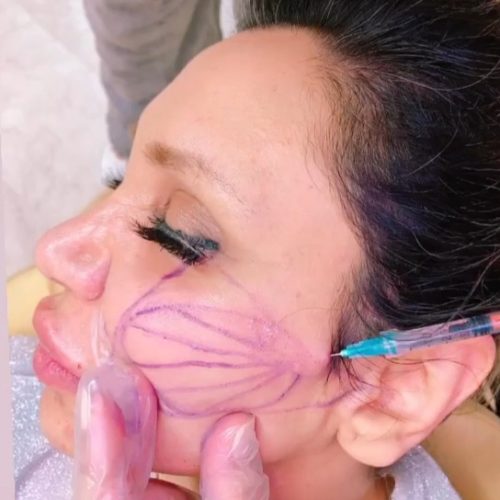 دستیار پزشک زیبایی ژل/بوتاکس